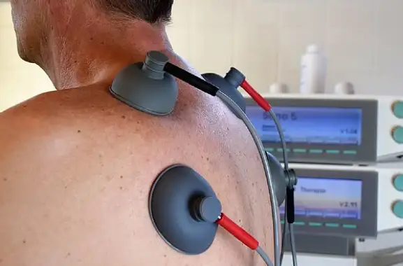 5 Myths About Electrotherapy